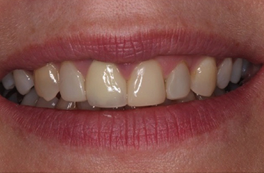 Linden Dental Surgery - After