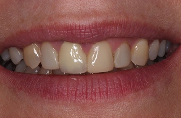 After - Linden Dental Surgery