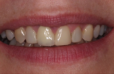 After - Linden Dental Surgery