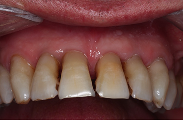 Linden Dental Surgery - After