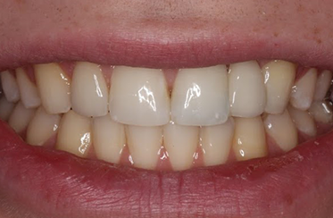 Linden Dental Surgery - After