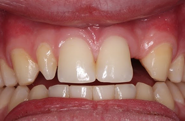 Linden Dental Surgery- Before