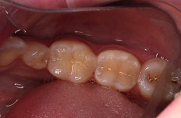 After - Linden Dental Surgery