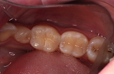 After - Linden Dental Surgery