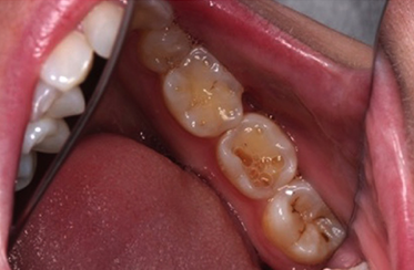  Linden Dental Surgery- Before