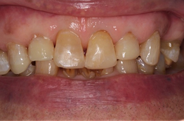 After - Linden Dental Surgery