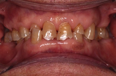 Before - Linden Dental Surgery