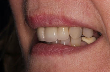 After - Linden Dental Surgery