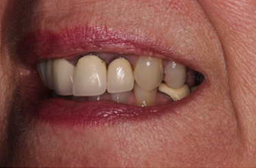 Before - Linden Dental Surgery