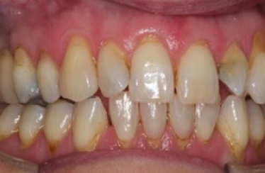 After - Linden Dental Surgery