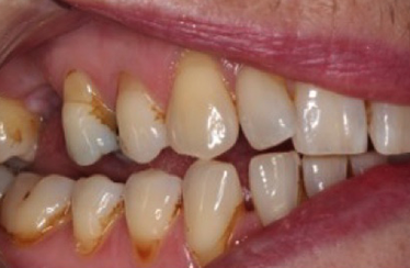 Before - Linden Dental Surgery