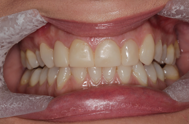 Linden Dental Surgery - After