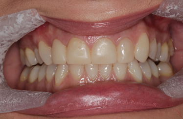 After - Linden Dental Surgery