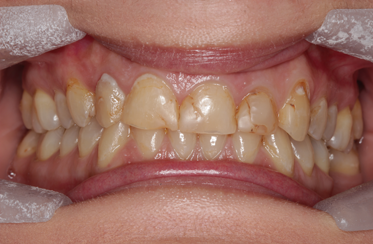  Linden Dental Surgery- Before