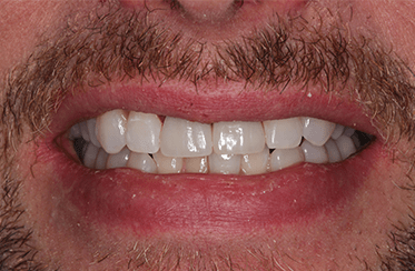 After - Linden Dental Surgery