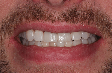 After - Linden Dental Surgery