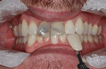  Linden Dental Surgery- Before