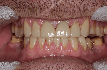 After - Linden Dental Surgery